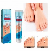 Крем для лечения грибка ногтей 20 гр.1 шт.: https://cena-optom.ru/krem-dlya-lecheniya-gribka-nogtey-20-gr-1-sht/